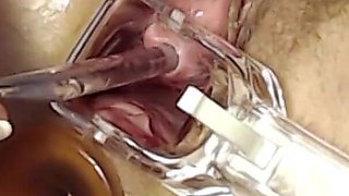 Extreme Pussy Play with Speculum and Peehole Fuck