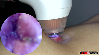 Arisa’s Bellybutton Twitches Under the Microscope on the Clinic Bed-wet, Stretched, Sucking and Begging for More.