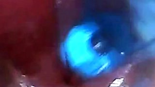 Endoscope POV Test Tube Cock Urethral Insertion