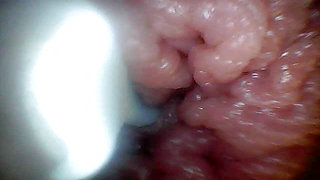 Endoscope camera shows the most sensitive parts of the penis Educational video