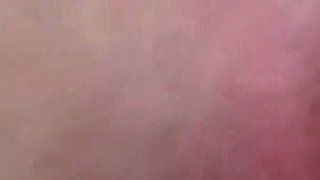 Margot Pees with a Big Bruise on Her Leg