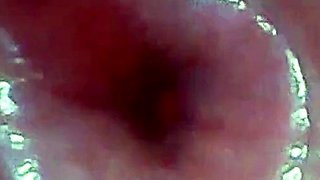 Endoscope POV: Test Tube Cock Urethral Insertion