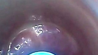 Endoscope POV: Test Tube Cock Urethral Insertion
