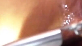 Speculum Cervix & Anal Exam Great View Inside