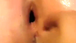 Extreme Anal Fisting, Gaping and Huge Rosebudprolapse