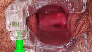 Cervical Screening of Hairy Granny Lola Wild