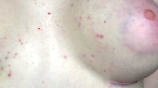 Revealing My Boobs After Breast Reconstruction (3-week Progress Update)