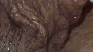 Step son couldn't take care of his erection with broken arm so he asked step mom a handjob