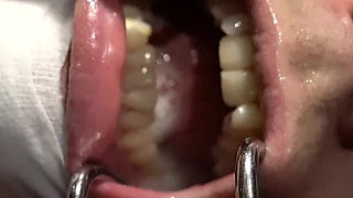 Spit and More Spit! Let Me Just Cover You!