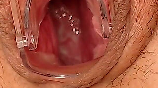 Gyno Fetish Searching Cervix - Wide Opened Pussy with Gyno Mirror