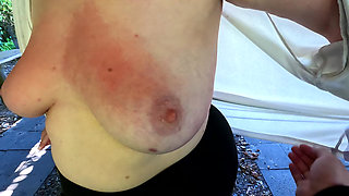 Red and Swollen Tits at Public Bbq Place